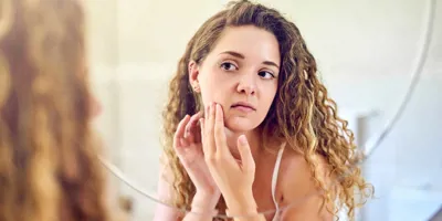 Mlada žena se gleda u ogledalu i istiskuje prištić na masnoj koži