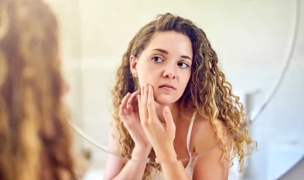 Mlada žena se gleda u ogledalu i istiskuje prištić na masnoj koži